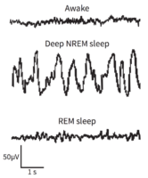 brainwaves of awake, NREM sleep and REM sleep